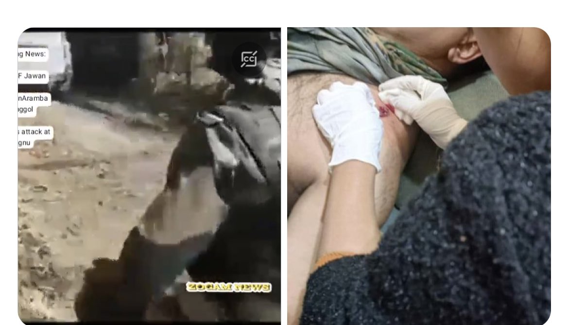 TheBlueHills49's tweet photo. ‼️This is the bullet that was fired by the #KukiMilitants and hit the #BorderSecurityForce Jawan in his shoulder ‼️

Another 1 inch , it could have been a different stories .

India 🇮🇳 needs to give a ‘Free hand’ to Manipur Govt just as @SwarajyaMag  had suggested and tackled the #KukiTerrorism and ensure that another #KukiMilitants bullet or Bombs doesn’t kill a Jawan or a police or Villagers .