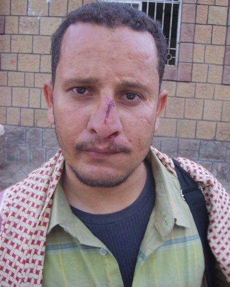 لا تفرحوا يا حوثة بأنيس منصور.
اليوم معكم وبكره عليكم..
كلنا نعرفه ونعرف أنه مجرد أداة لمن يدفع ويوجه.
راجعوا تاريخه وستجدوا أنه أكبر المتحولين في التاريخ.
لا تطبلوا له ولا تمجدوه ولا تمدحوه.
ستندمون كثيراً.
#الحوثي_منظمه_ارهابيه_عالميه
#TheHouthiIsAGlobalTerroristOrganization