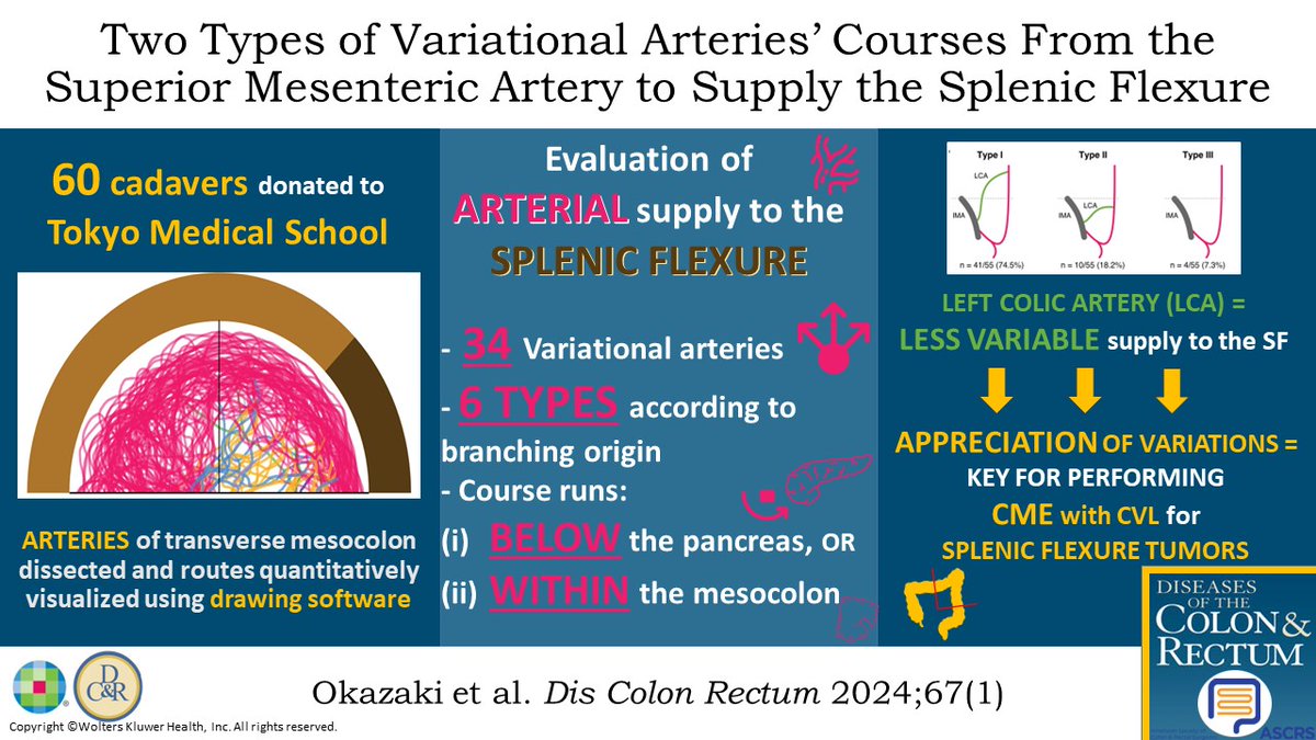Two Types of Variational Arteries' Courses From the Superior Mesenteric Artery to Supply the Splenic Flexure: Gross Anatomical Study - highlighted in a recent #DCRJournal visual abstract: bit.ly/4aaQoL4 @ScottRSteeleMD @Swexner @me4_so @ACPGBI @drtracyhull @ASCRS_1