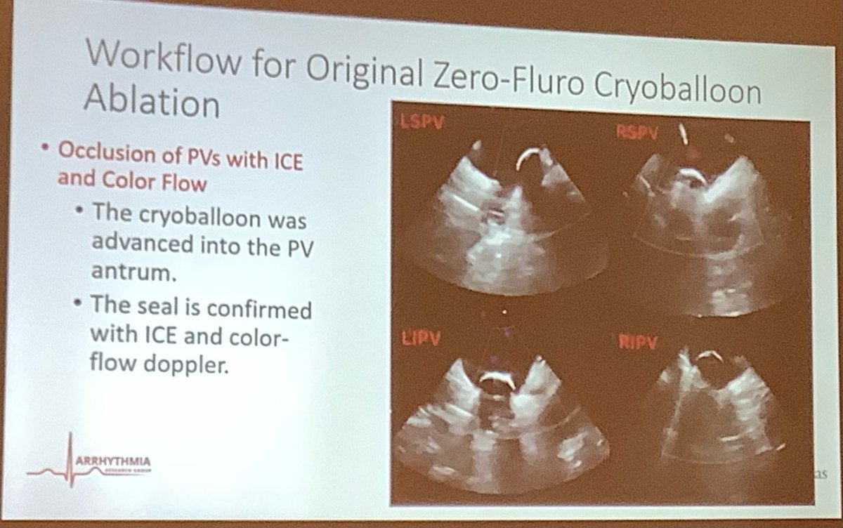Terrific research presentation given by ⁦#ACCFIT ⁦@DrBridgetLee⁩ describing ⁦@Drdevignair⁩ Arrhythmia Research Group impressive work with zero-fluoro cryoballoon PVI at ⁦@ArkansasAcc⁩ ⁦meeting. ⁦@uamshealth⁩ ⁦@ACCinTouch⁩