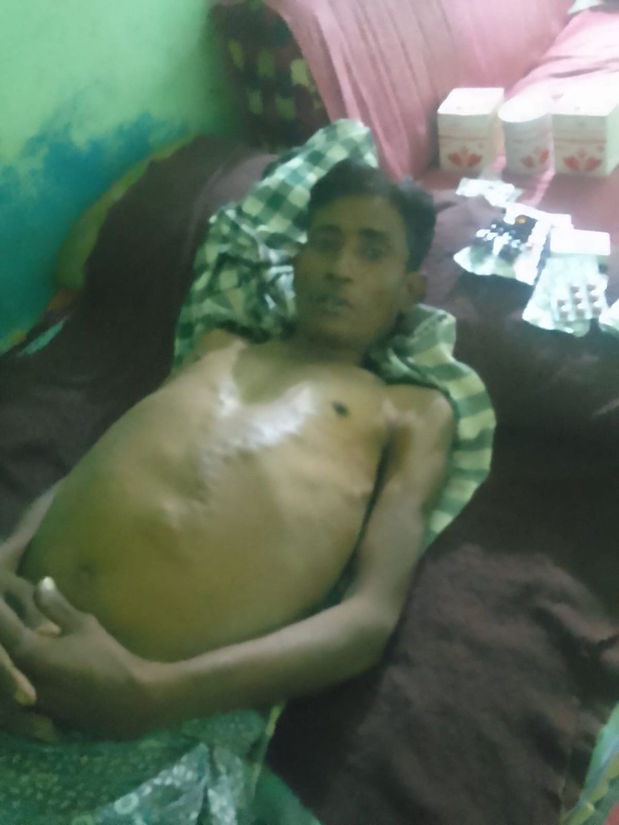 #ନୟାଗଡ ଜିଲ୍ଲା #ଓଡ଼ଗାଁ ବ୍ଲକ୍ #କୋମଣ୍ଡ ଗ୍ରାମର ପବିତ୍ର କୁମାର ପଲାଇ ଦୀର୍ଘ ଦିନ ହେବ କିଡନୀ ରୋଗ ରେ ପୀଡ଼ିତ #ଅର୍ଥ ସାଜିଛି ବାଧକ ଦୃଷ୍ଟି ଦେବାକୁ ଅନୁରୋଧ <a href="/CMO_Odisha/">CMO Odisha</a> <a href="/AdmnNayagarh/">Collector & DM Nayagarh</a> <a href="/CdmoNayaga41580/">CDMO Nayagarh</a> <a href="/Vkpandianfancl1/">Vkpandianfanclub</a> <a href="/HFWOdisha/">H & FW Dept Odisha</a> <a href="/MoHFW_INDIA/">Ministry of Health</a> <a href="/BPSethi/">Bishnupadaa Setthi</a>