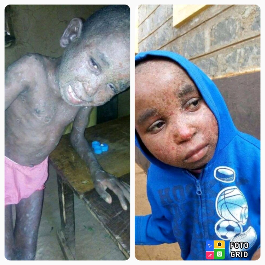 VictorMuthoni1's tweet photo. It doesn't matter what people say, Jesus has the final word. It doesn't matter what the doctors have said about your situation, Jesus has the final answer. This coming March  Menengai 6 .Date 15-17,#Menengai6Revival https://t.co/I8BWEK50Zp