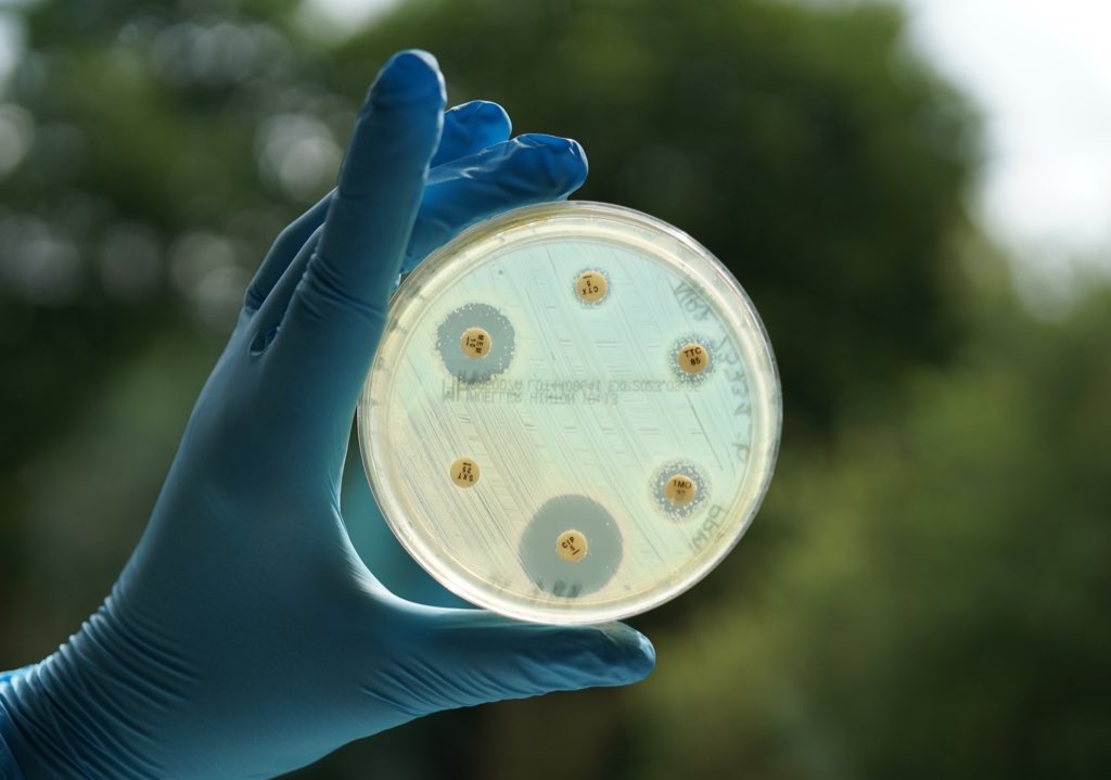 Axel Hamprecht (@a_hamprecht) on Twitter photo Neue Stelle als Laborleitung (E14/Postdoc)i n tollem Team am Institut für medizinische Mikrobiologie und Virologie im schönen Oldenburg
@UniOldenburg
Spannende Forschung zu Antibiotikaresistenz/One Health
uol.de/stellen?stelle…
#AMR <a href="/jungedghm/">jungedghm</a> <a href="/junite_e/">jUNITE- Netzwerk Junge Infektionsmedizin e.V.</a>
Please RT Neue Stelle als Laborleitung (E14/Postdoc)i n tollem Team am Institut für medizinische Mikrobiologie und Virologie im schönen Oldenburg
@UniOldenburg
Spannende Forschung zu Antibiotikaresistenz/One Health
uol.de/stellen?stelle…
#AMR <a href="/jungedghm/">jungedghm</a> <a href="/junite_e/">jUNITE- Netzwerk Junge Infektionsmedizin e.V.</a>
Please RT