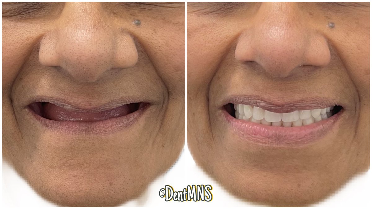 مُنيرة tweet media