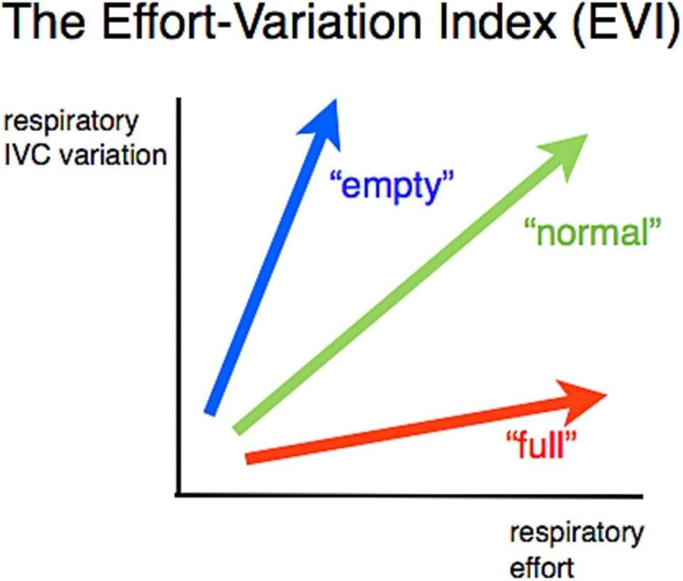 ZHeart11768530's tweet photo. 🔴 What every intensivist should know about the IVC #2024Review

https://t.co/X1PnzZ5kCU
#CardioEd #CardioTwitter #cardiology https://t.co/9WftLaI8la
