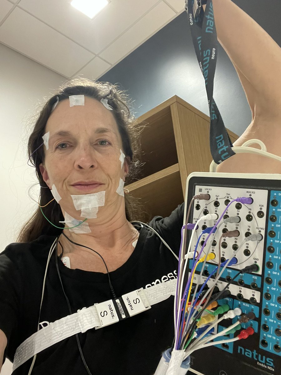 AmyCookOC's tweet photo. Daily for years (forever). Not weeks to months. #LongCovid #POTS #Retina #TBI #Tinnitus #Neuropathy #GI #hairloss #QoL #PurpleToe #Insomnia #SVT https://t.co/iBwexgzsCS