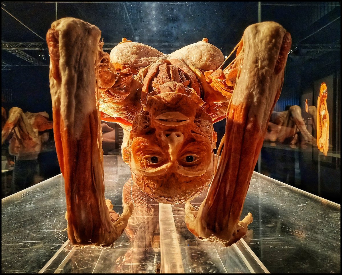 k_pawlowska's tweet photo. #JustNow
#AfternoonTrivia
“Life isn't about finding yourself. Life is about creating yourself.” -G.B.Shaw
I have just seen increadible "The BODY WORLDS" exhibition from the VITAL series ... and I'm impressed 🤩
#BodyWorldsExhibition #Vital
#AmberExpo https://t.co/FV98KGSiqT