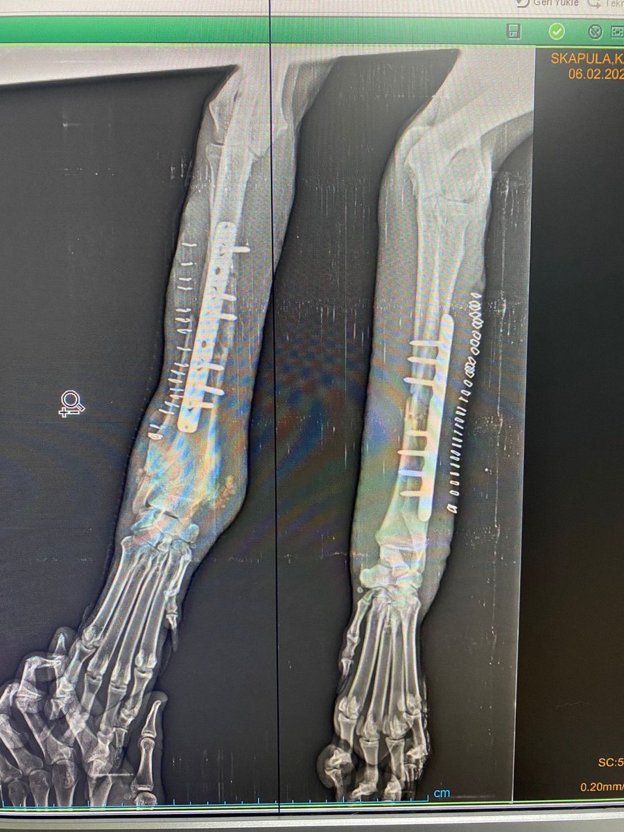 devnazofficial's tweet photo. Can you believe this dog will walk again? Both her legs were completely snapped off from the bone. Watch her amazing survival story on our channel. #devnaz #bone #kangal #rescue #ibrahimkeloğlanTUTUKLANSIN #SokakHayvanlariSahipsizDegildir https://t.co/uBexmkcGee