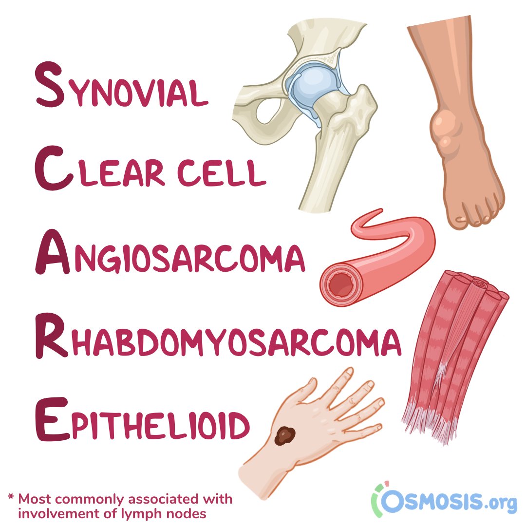 OsmosisMed's tweet photo. For #WorldCancerDay, today's #ClinicalPearl is on sarcoma, an aggressive cancer that affects soft tissue. Use the handy mnemonic "SCARE" to easily remember the five histologies of sarcomas with lymph node involvement!

Learn more: https://t.co/sGzjpra1v8 https://t.co/Esw1WKRZL2