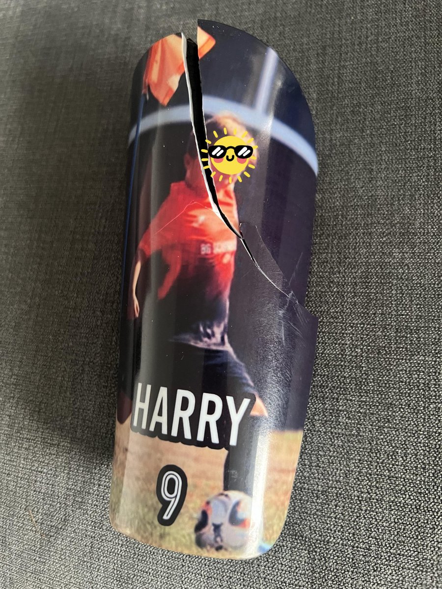 "Thank god for shin pads, the crack was loud enough for touchline supporters to hear, initially I worried it was his leg, This is a perfect example for anyone that chooses to ignore it or wear the miniscule pads, the outcome could’ve been very different!"

A perfect example of