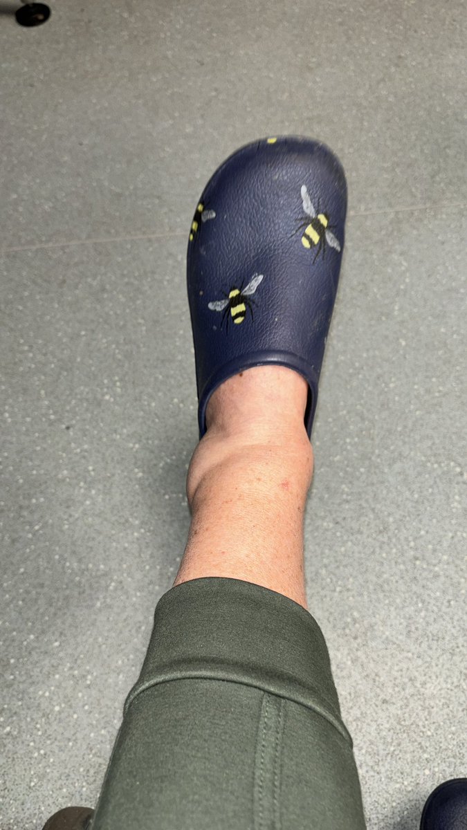 Downloaded the Merlin App ready for my Bird Spotting Session. Slipped & fell and am now in A & E. Ankle like a football, thinking ligament hopefully but the pain is horrendous , can’t put on floor & swelling by the minute !!! Husband shaking head