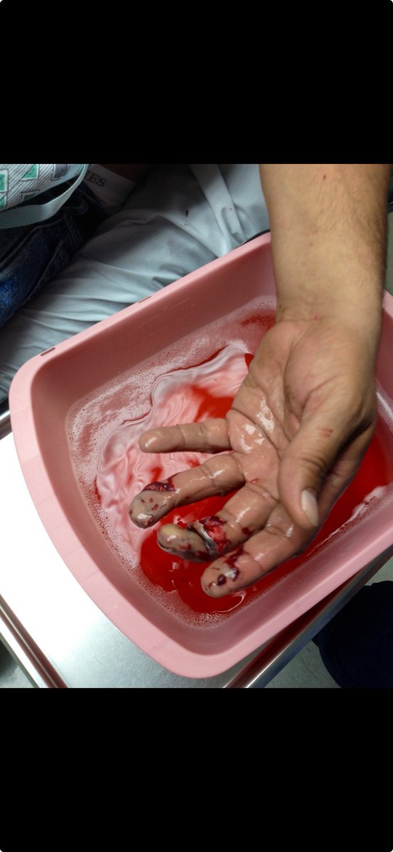 I Can’t believe it’s been 12 years since this happened. Driving fence post building paddocks at the farm.