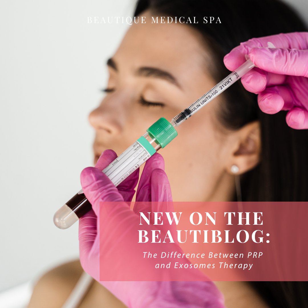 🌟 Discover why exosome therapy is the superior choice over PRP! 🚀 Dive into our blog to learn more and schedule your appointment today to experience the amazing benefits!
 
𝗟𝗘𝗔𝗥𝗡 𝗠𝗢𝗥𝗘: bit.ly/3OMHRoC

#mcallentx #exosometherapy #prpfacial #skincare #antiaging