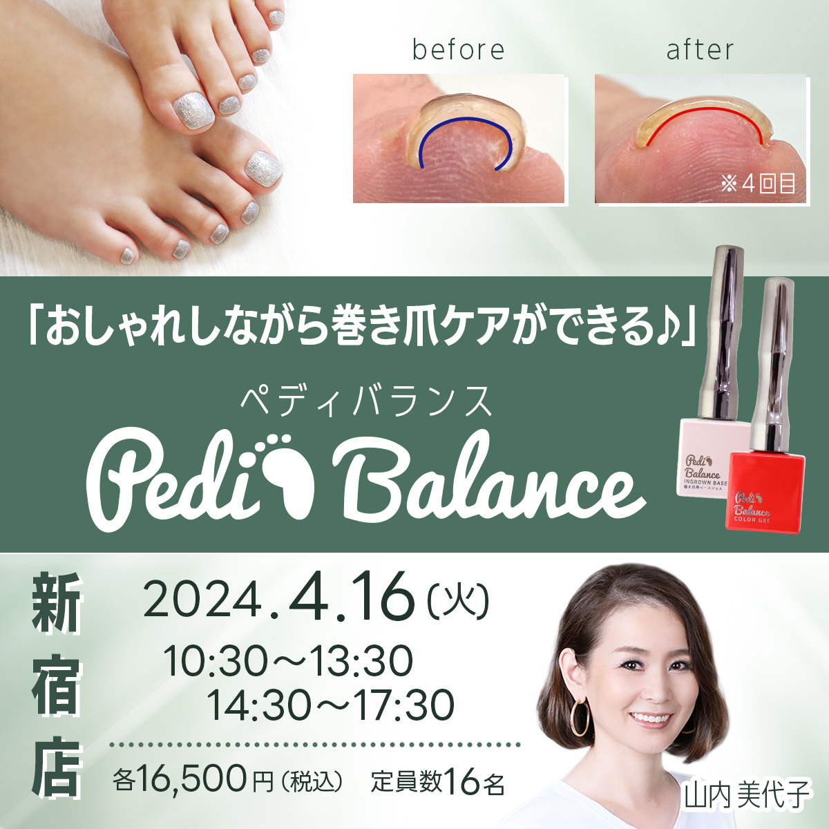 注文 ペディバランス 巻爪ケアジェル 2色セット ペディバランス 巻爪