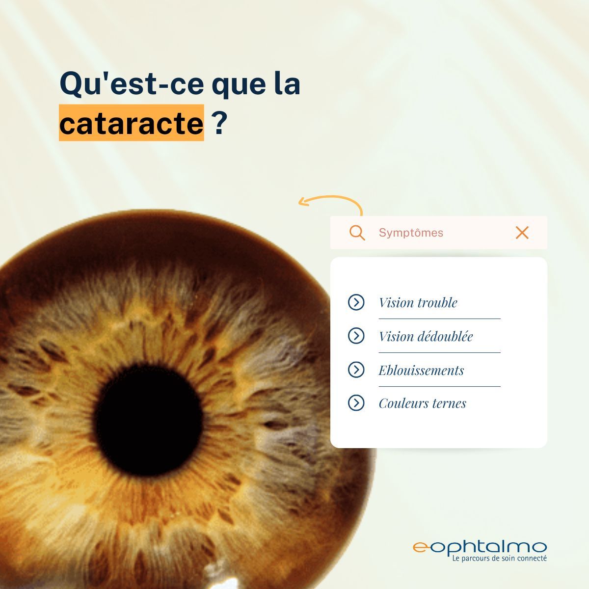 eophtalmo's tweet photo. 1 fois sur 4, le problème oculaire détecté chez nos patients de +60 ans est une cataracte. https://t.co/vfoooaK3rO