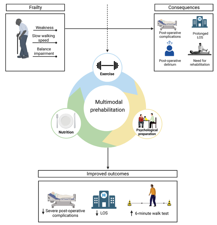 Can prehabilitation improve outcomes after surgery in older adults?

This meta-analysis of 16 studies found combined exercise, nutritional, and psychological prehabilitation (before abdominal surgery):

- Reduced the risk of severe complications (by 44%)
- Decreased length of