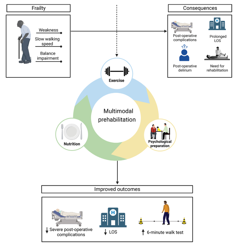 Can prehabilitation improve outcomes after surgery in older adults? This meta-analysis of 16 studies found combined exercise, nutritional, and psychological prehabilitation (before abdominal surgery): - Reduced the risk of severe complications (by 44%) - Decreased length of