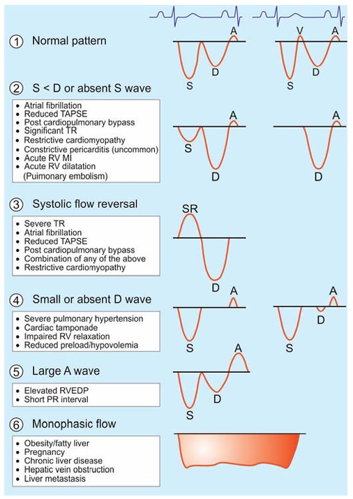 NephroPOCUS tweet media