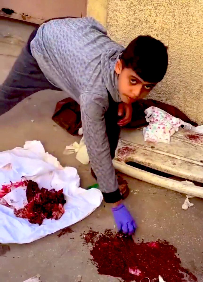 طفل فلسطيني من غزة يجمع بقايا اشلاء والدته..

#حماس_تمثل_امه_الاسلام