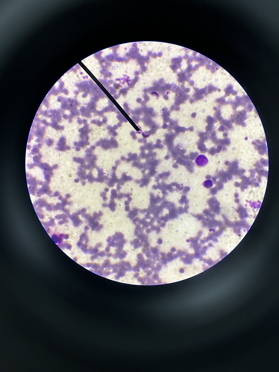 parasitology lab: plasmodium falciparum (gametocyte) under the microscope 🔬 
histopath lab exam 😵‍💫