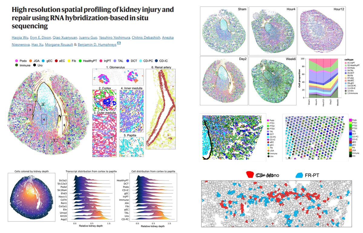 Spatial Atlas of🐭#AcuteKidneyInjury-Repair
Ischemia-Reperfusion Injury 4h/12h/2d/6wk

Diversified immune cell-segmented tubular epithelium interactions!

Love to see further exploration into spatially-resolved dynamics of glomerular #EndothelialCell, #Pericytes & interstitial…
