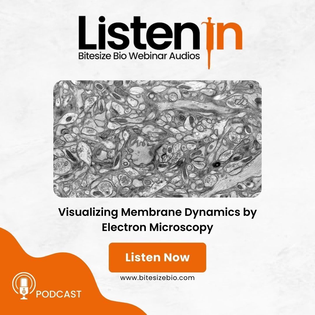 Dive into the powerful #ElectronMicroscopy and #VolumeImaging tech to spatially and temporally resolve fast synaptic transmission events 🧠🔬 all in the latest episode of #ListenIn. #Neuroscience #Microscopy #Neurons 🎧 Check it out → buff.ly/3tj5vS5