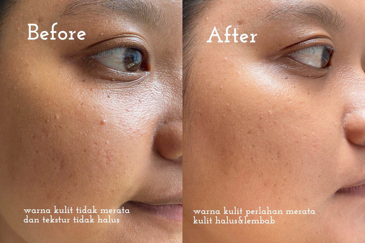 plumpypum's tweet image. GAK LAGI-LAGI DEH ISENG NYOBAIN KARENA PENASARAN… EH TAUNYA MOIST SKINTIFIC YANG PINK SEBAGUS ITU 🫠🫠

Liat deh hasilnya kulitku jadi mendingan banget, harus segera restock ini mah kalau abis 😭😭

#pumereview