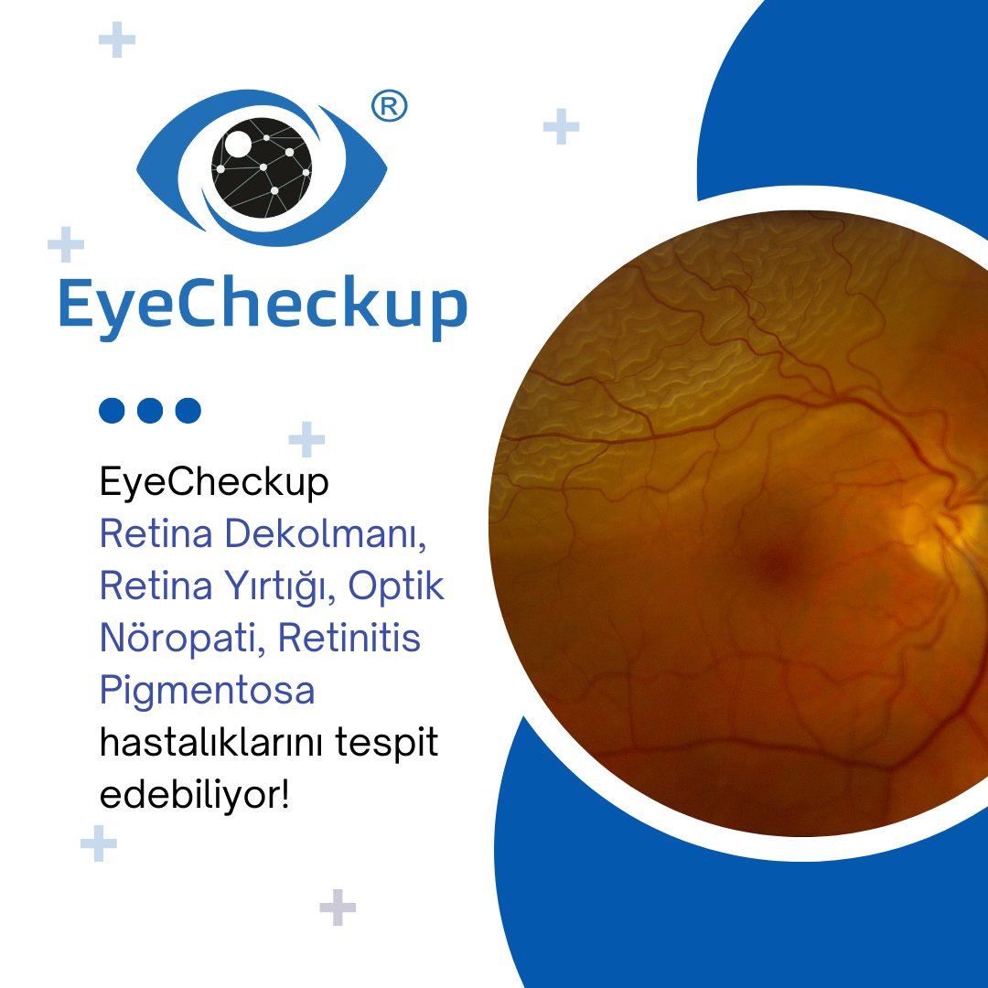 EyeCheckup - Early Diagnosis AI system (@eyecheckup) on Twitter photo EyeCheckup Göz Hastalıklarına yönelik teşhis sistemini geliştirerek daha fazla hastalık tespit edebilme yolunda emin adımlarla devam ediyor.
#glokom #sarınokta #100optical #AI #gözhastalıkları #diyabetikretinopati #oftalmoloji #retina #yatırım #yatırımtavsiyesi EyeCheckup Göz Hastalıklarına yönelik teşhis sistemini geliştirerek daha fazla hastalık tespit edebilme yolunda emin adımlarla devam ediyor.
#glokom #sarınokta #100optical #AI #gözhastalıkları #diyabetikretinopati #oftalmoloji #retina #yatırım #yatırımtavsiyesi