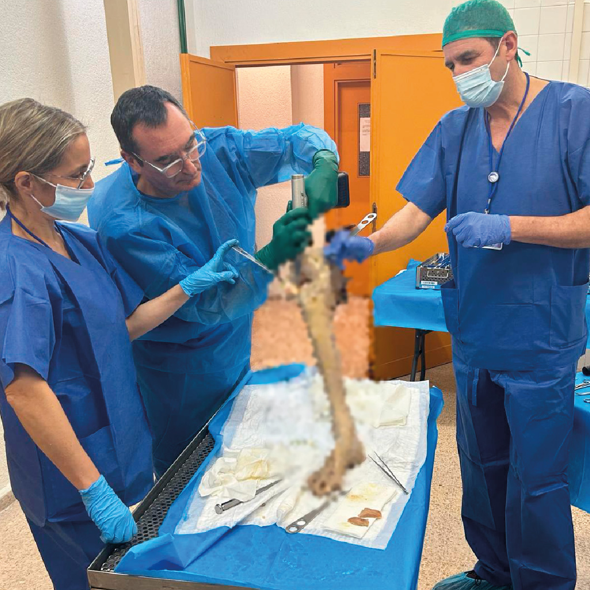 🇪🇸ICAR presente en #Vizcaya con el <a href="/drvleon/">Vicente León Muñoz</a> en el VIII Laboratorio de cirugía en cadáver, técnicas de artroplastia de #rodilla🦵🏼. El evento tuvo lugar en la Universidad #PaísVasco (UPV / EHV).
.
#Ortopedia #Salud #Instituto #Traumatología #Medicina #knee #rodilla #cirugía