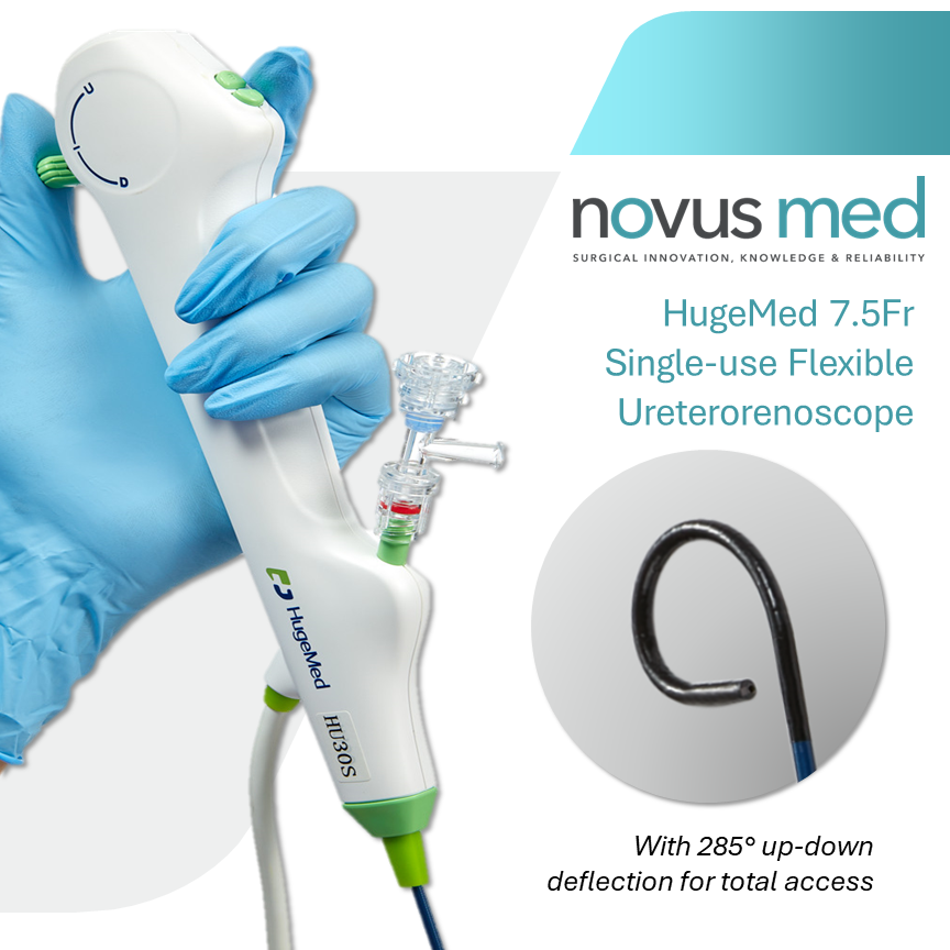novus med (@novus_med) on Twitter photo 🧭Access All Areas - with our 7.5Fr, 285° ⬆️⬇️ deflection HugeMed single use #fURS. With a choice of 3 and 9 o'clock channels, the stone cant hide from you! 🙈
For an evaluation, contact us on:
customerservice@novus-med.com 🧭Access All Areas - with our 7.5Fr, 285° ⬆️⬇️ deflection HugeMed single use #fURS. With a choice of 3 and 9 o'clock channels, the stone cant hide from you! 🙈
For an evaluation, contact us on:
customerservice@novus-med.com