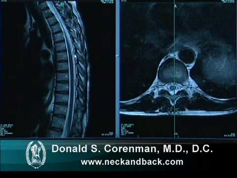 drcorenman's tweet photo. Check out this informative video on Understanding an #MRI of the Normal #ThoracicSpine! Ideal for primary care physicians, chiropractors, and physical therapists, it helps in reading and interpreting thoracic spine MRIs.
WATCH NOW! https://t.co/qrIDDzJbSV #MedicalEducation https://t.co/8LzxphxvIP
