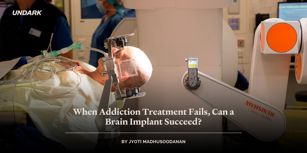 Some neurosurgeons have begun to offer deep brain stimulation, which uses implanted electrodes to tamp down problematic neural signals, as a last-ditch treatment for people struggling with opioid use. Others question the hype. 🔗: bit.ly/3Sg4geX