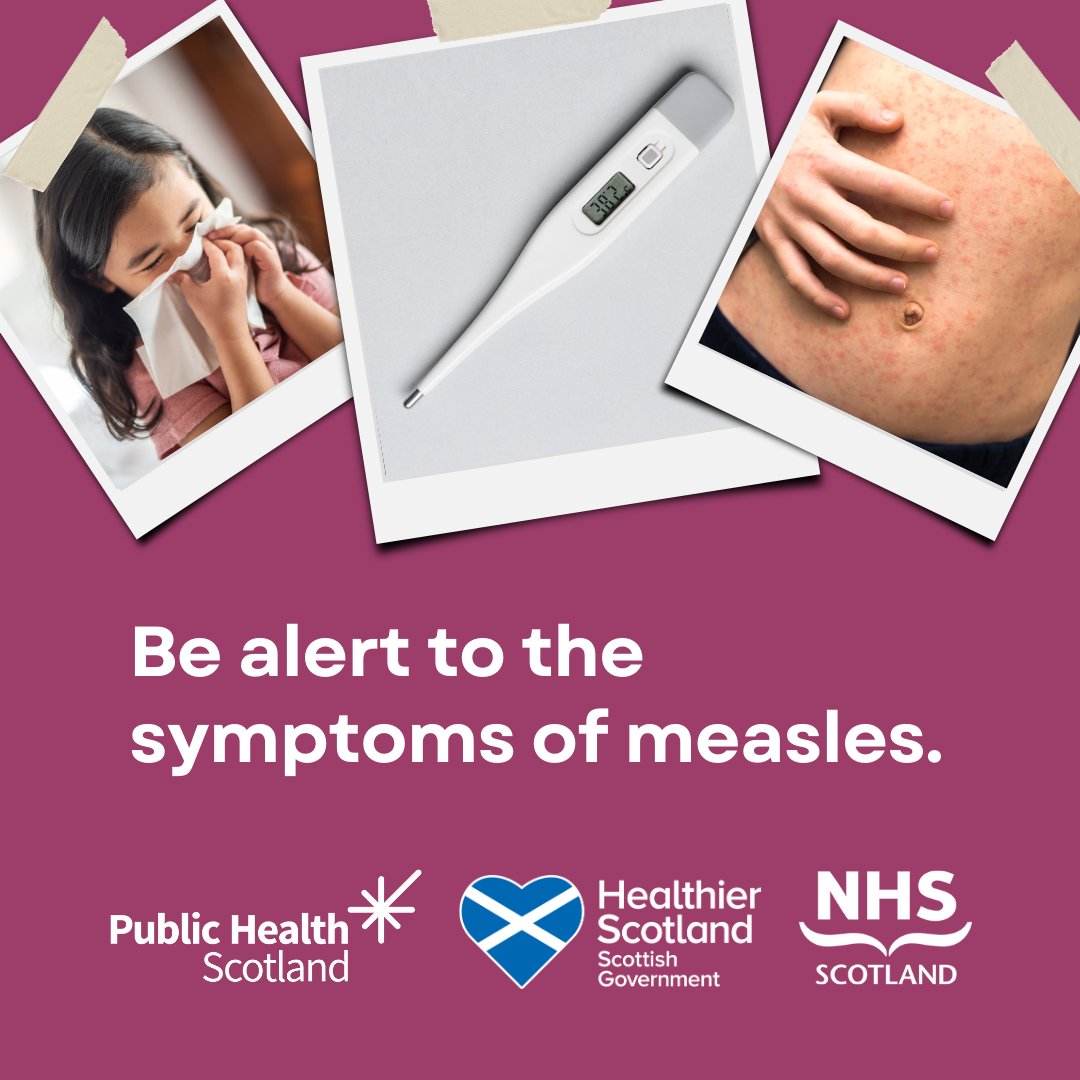 NHSWI's tweet photo. Cases of measles are on the rise. So, it’s important to be aware of the symptoms.

Find out about the signs and what to do if you think your child has measles at https://t.co/yqPkq2xIHR

#MMRagainstMeasles https://t.co/isDbSwaegb