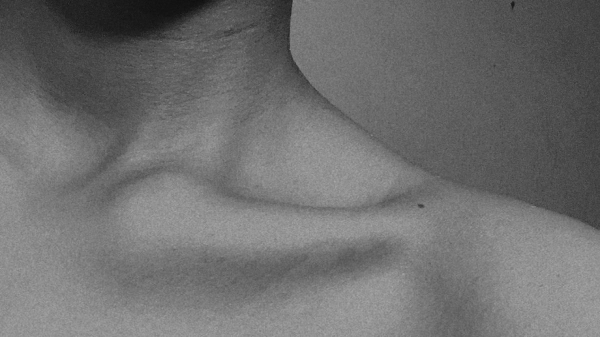 APC see my neck 😭😭💔