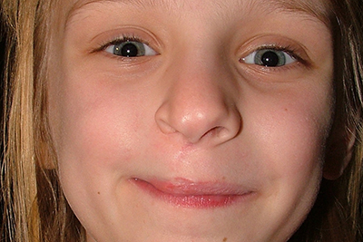 University of Bristol (@bristoluni) on Twitter photo A new research programme – thanks to <a href="/NIHRresearch/">National Institute for Health and Care Research</a> - could help all young adults with #cleft lip and palate have the same chance of achieving the best possible outcomes when moving to adult care.
👉 brnw.ch/21wH76O
#CleftResearch #HealthEquality <a href="/CleftCollective/">The Cleft Collective</a> A new research programme – thanks to <a href="/NIHRresearch/">National Institute for Health and Care Research</a> - could help all young adults with #cleft lip and palate have the same chance of achieving the best possible outcomes when moving to adult care.
👉 brnw.ch/21wH76O
#CleftResearch #HealthEquality <a href="/CleftCollective/">The Cleft Collective</a>