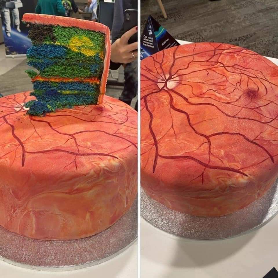 GLAUCOMA tweet media