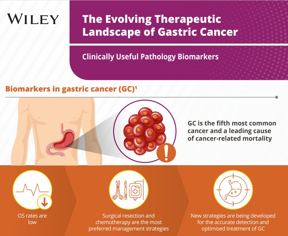 #GastricCancer is the fifth most common cancer and a leading cause of cancer-related mortality. Find free infographics on our Gastric Cancer Knowledge Hub to share the importance of #biomarkers in consideration of gastric cancer. gastric-cancer.knowledgehub.wiley.com/wp-content/upl…