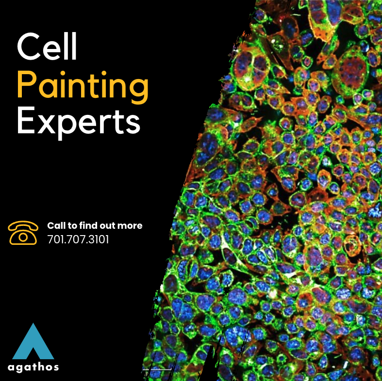 AgathosBio's tweet photo. 🔬✨ Illuminate the intricacies of cellular biology with Agathos Biologics' advanced imaging techniques! Our high-throughput, multiparametric cell painting service enables you to delve deep into the inner workings of cells like never before. Contact us today! info@agathos.bio https://t.co/bqHbmyEGDL