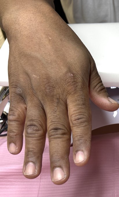 Yeah! Now, I do MANicure to my guys too!🤭  Look at that&hellip; Hands ready to finger my pussy! 😎 https://t<a href="/tag/mvsales"class="tags"><span>#mvsales</span></a>