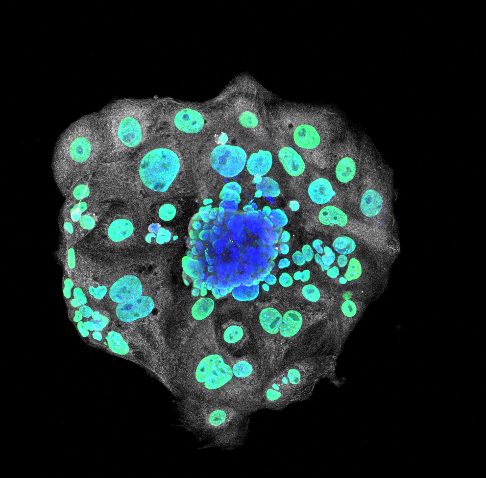 Mouse-tastic Implantation Spectacle!
#ScienceSpectacle #ImplantationInAction

By Xinjian Doris He, PhD student <a href="/UMassVASCI/">UMass Veterinary and Animal Sciences Dept</a> and finalist in the Graduate School’s #ImagesofResearch competition! 

Vote for your favorite images here: instagram.com/umass_opd/?hl=…
