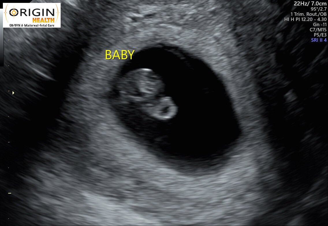 Caffeinated26's tweet photo. We first heard your heartbeat today and you are just perfect to us already ❤️ see you in Oct Beanie xoxo mom and dad https://t.co/7xwmGcHGKt