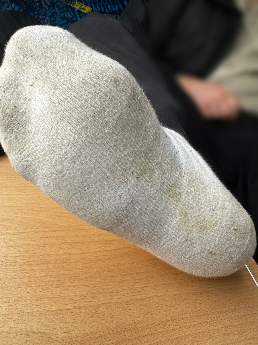 albturkporn's tweet photo. I love showing off my smelly feet on the train and seeing how footslaves look at them. DM for buying smelly socks and underwear. 
 #feetslaves #paypig #sweatyfeet #smelly https://t.co/WaPfRsMRJ7