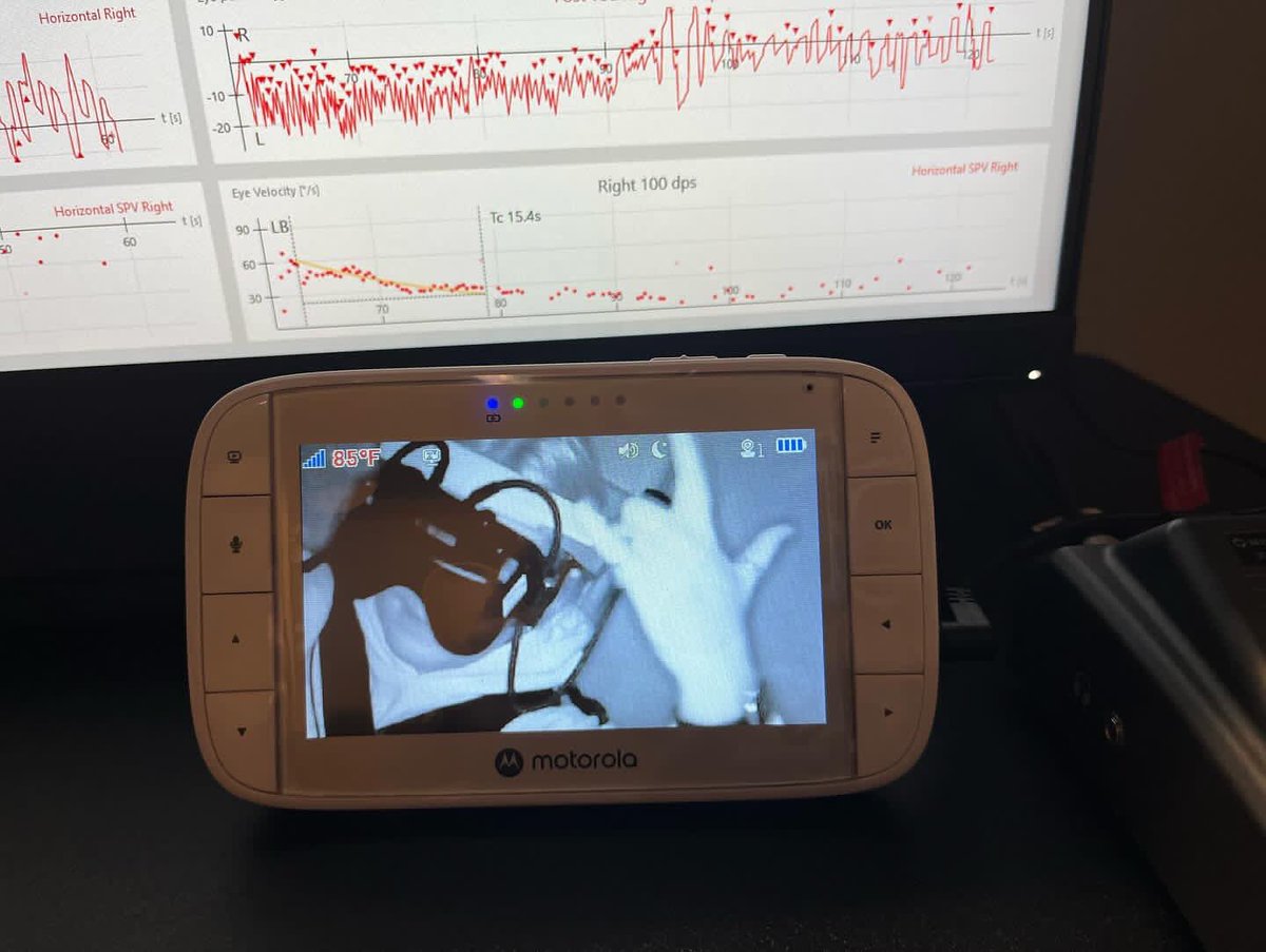 UChicagoHearing's tweet photo. When you get a new rotary chair, youโve to put it through the paces!
Our Balance Team at River East did just that to our newest piece of equipment! Itโs another piece of the puzzle to help us diagnose and treat our patients!
#vestibular #balance #audiology #balancehealth https://t.co/bZU0Zv7nsv