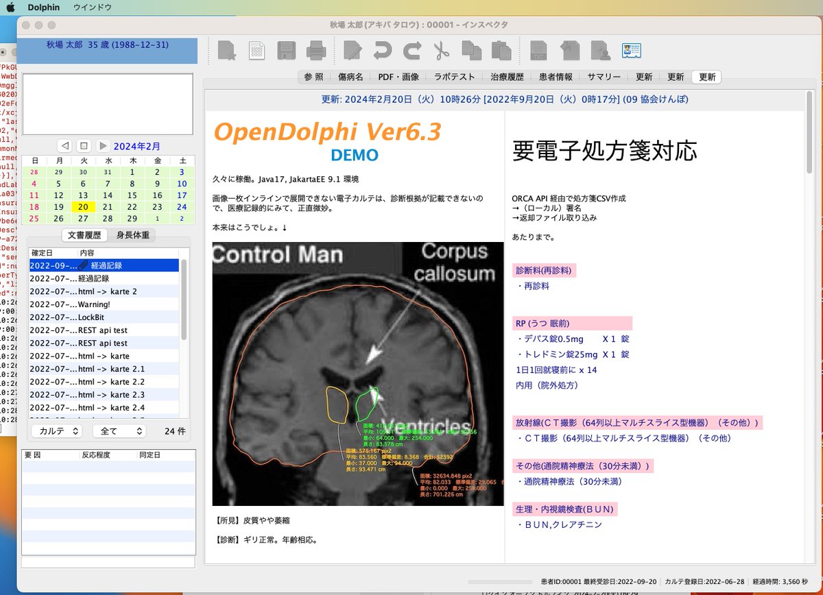H_Inomata's tweet photo. ひさびさに稼働。
電子処方箋は、適当なタイミングで診療行為を ORCA
 api/api21/medicalmodv2?class=05
に送ると処方箋CSVが返ってくるので、これを利用。
#opendolphin https://t.co/QKVXpEwNwp