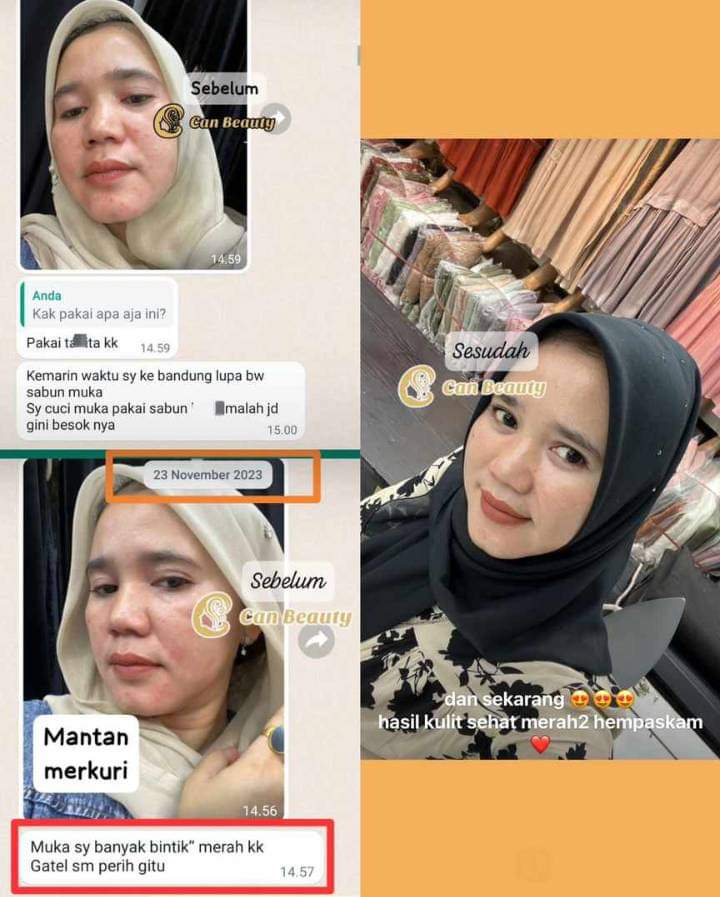 cimenk66's tweet photo. Biar cantik kayak Grace Natalie atau kayak cewek Jepang
Cek link : https://t.co/Smwf6W7xKQ
#binus #rigen #skincare #skincareproduk #healthskin #beauty #beautytips #Hercules #Thailand #HargaiYangKerjaDiTPS #konser https://t.co/F7CZt99Gst