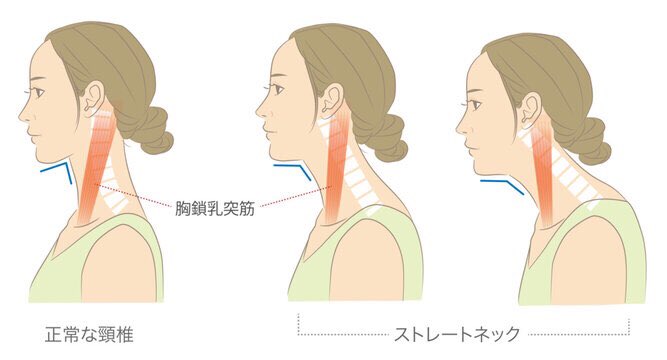 easy_E916's tweet photo. Studies show that between 27-48% of workers have neck problems each year. This statistic is from worldwide research involving people from all industries, including those in office settings.

Is it also true you only level out your beats? I be doing too much then. https://t.co/np0323IjXQ
