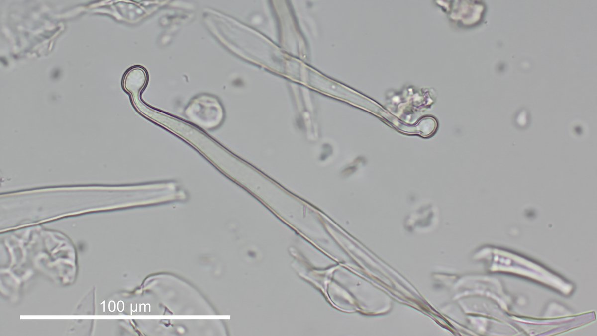 Currently working on a manuscript about dicot phytoliths. Some are incredibly fascinating. Next time you feel the sharp sting of a nettle (Urtica), just think about the intricate beauty of the stinging microhairs that got to you (the irritating chemicals are in the bulbous head)