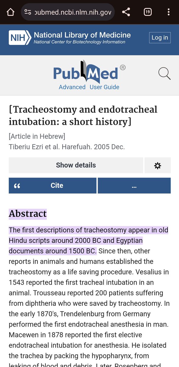 I was today years old when I learned tracheostomies were used as far back as 2,000 BC 🤯 What did old trachs used to look like?! Okay. If I could travel anywhere inside the Doctor's TARDIS with the Doctor, THIS I GOTTA SEE! Euh. If they would take me... 🥺👉🏼👈🏼 #RespiratoryTherapy