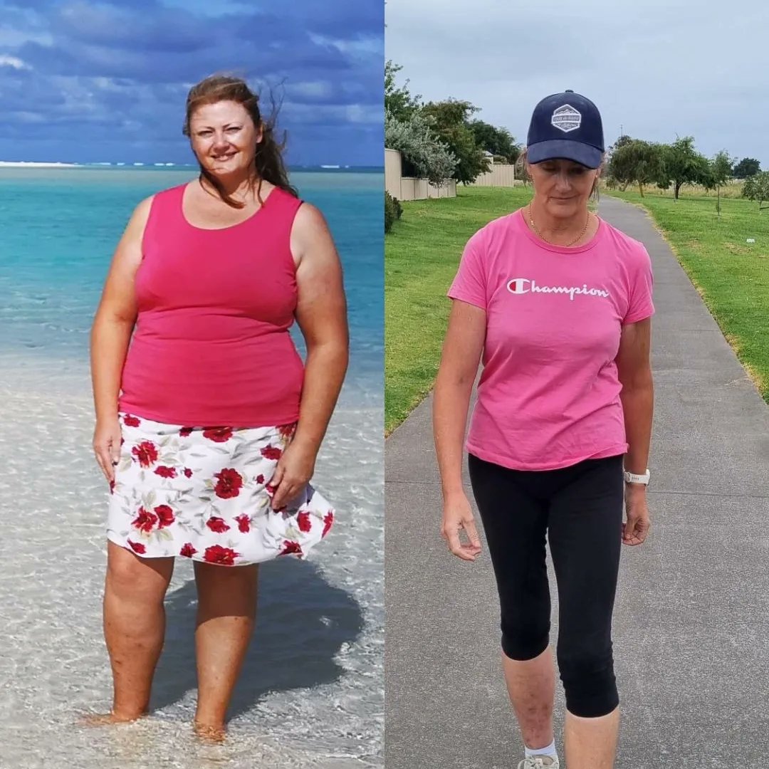 BakeJoy's tweet image. What a difference a year makes.

41 kilograms / 90 pounds gone!

Also gone:
Brain fog
Back &amp;amp; shoulder pain
Foot pain
Headaches

Snoring completely stopped
Allergies drastically reduced
Energy restored
Sleep improved 

Thank you @drjasonfung

#ketodiet
#carnivorediet
#fasting
