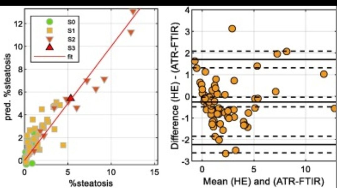 New study assess infrared spectroscopy as a tool for real-time, quantitative evaluation of liver steatosis during surgery. Quick, stable, and cost-effective liver graft assessments. #ATRFTIR #LiverSteatosis  <a href="/IISLaFe/">IIS La Fe</a> <a href="/Leitat/">Leitat</a> <a href="/GRQuintas/">GQuintas</a>
@RiendaPath